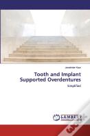 Tooth And Implant Supported Overdentures