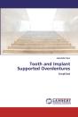 Tooth And Implant Supported Overdentures - Preview