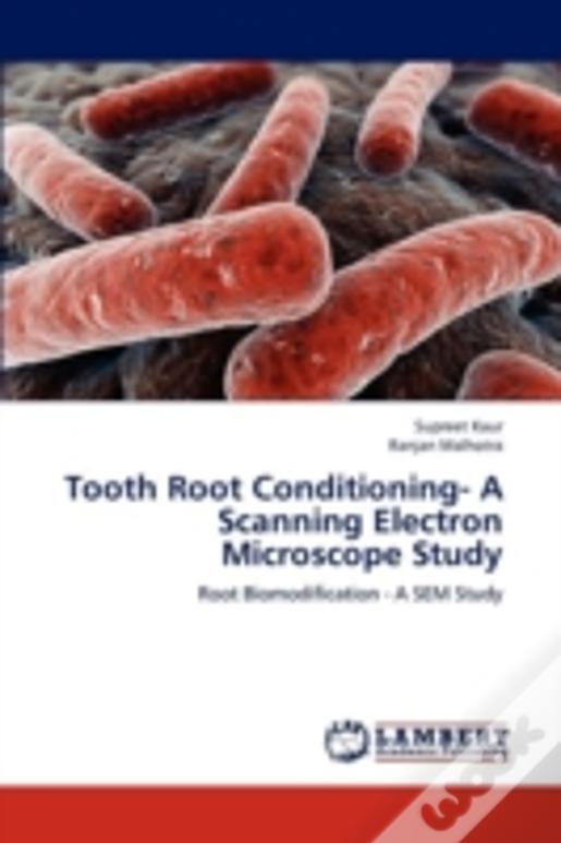Tooth Root Conditioning- A Scanning Electron Microscope Study