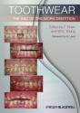 Toothwear - Preview