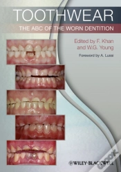 Capa do artigo Toothwear