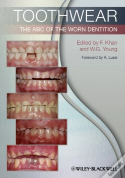 Capa do artigo Toothwear