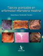 Tópicos Avanzados En Enfermedad Inflamatoria Intestinal - Preview