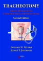 Tracheotomy - Preview