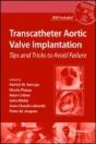 Transcatheter Aortic Valve Implantation - Preview