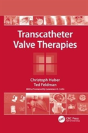 Transcatheter Valve Therapies - Preview