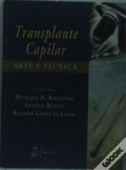 Transplante Capilar - Arte e Técnica