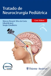 Capa do artigo Tratado De Neurocirurgia Pediátrica