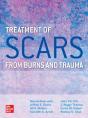 Treatment Of Scars From Burns And Trauma - Preview
