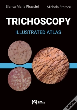 Capa do artigo Trichoscopy