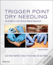 Trigger Point Dry Needling