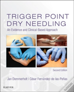 Capa do artigo Trigger Point Dry Needling