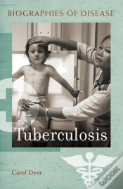 Capa do artigo Tuberculosis