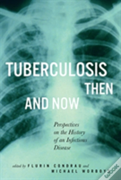Capa do artigo Tuberculosis Then And Now