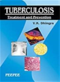 Tuberculosis - Preview