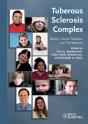 Tuberous Sclerosis Complex - Preview