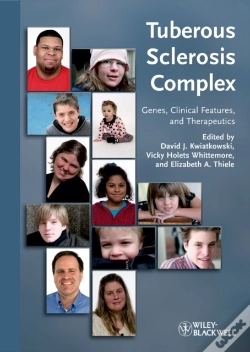 Capa do artigo Tuberous Sclerosis Complex