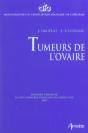 Tumeurs De L'Ovaire - Preview