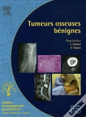 Capa do artigo Tumeurs Osseuses Benignes