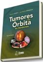 Tumores da Órbita de Henderson - Preview