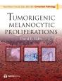 Tumorigenic Melanocytic Proliferations - Preview