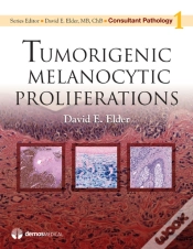 Capa do artigo Tumorigenic Melanocytic Proliferations