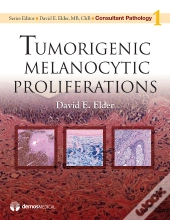 Tumorigenic Melanocytic Proliferations