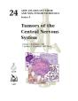 Tumors Of The Central Nervous System - Preview
