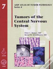 Tumors Of The Central Nervous System