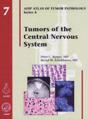 Tumors Of The Central Nervous System - Preview