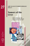 Tumors Of The Liver
