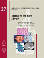 Tumors Of The Liver - Preview