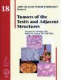 Tumors Of The Testis And Adjacent Structures - Preview