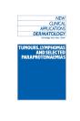 Tumours, Lymphomas And Selected Paraproteinaemias - Preview
