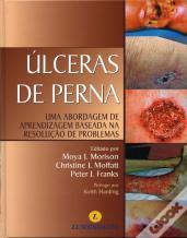 Úlceras de Perna