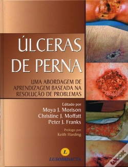 Capa do artigo Úlceras de Perna