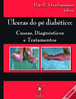 Capa do artigo Úlceras do Pé Diabético