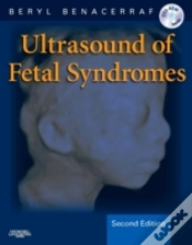 Capa do artigo Ultrasound Of Fetal Syndromes