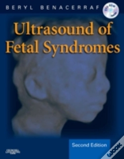 Capa do artigo Ultrasound Of Fetal Syndromes