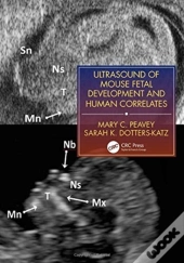 Ultrasound Of Mouse Fetal Development And Human Correlates