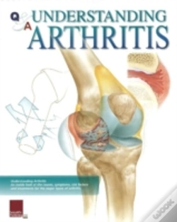 Capa do artigo Understanding Arthritis Flip Chart
