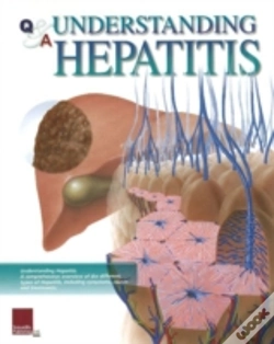 Capa do artigo Understanding Hepatitis Flip Chart