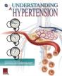 Understanding Hypertension Flip Chart - Preview