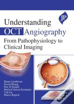 Understanding Oct Angiography
