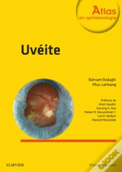Capa do artigo Uveite