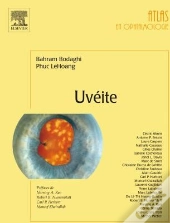 Uvéite