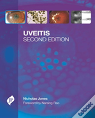 Uveitis