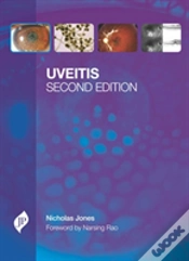 Capa do artigo Uveitis