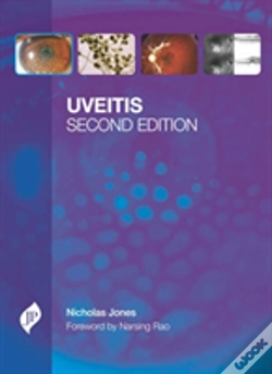Capa do artigo Uveitis