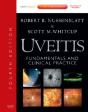 Uveitis - Preview